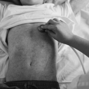 Terapia para sarampión, con ingrediente: sal