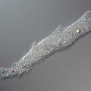 Terapia para los parásitos (amebas), con ingrediente: chichipince