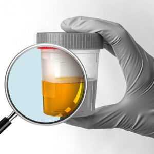 Terapia con bebida para mal de orín, con ingrediente: copinol