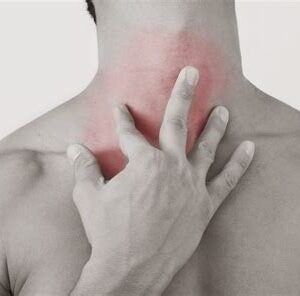 Terapia para afecciones de la garganta, con ingrediente: canela